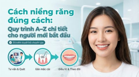 Cách niềng răng đúng chuẩn: Quy trình chi tiết từ A-Z cho người mới