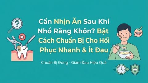 Nhổ răng khôn có cần nhịn ăn không? Bật mí cách chuẩn bị đúng để đỡ đau, mau hồi phục
