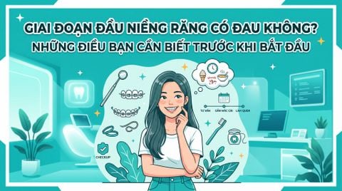 Giai đoạn đầu niềng răng có đau không? Những điều bạn cần biết trước khi bắt đầu