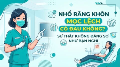 Nhổ răng khôn mọc lệch có đau không? Sự thật không đáng sợ như bạn nghĩ