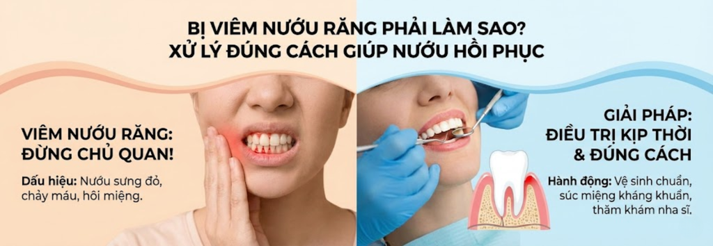 Bị viêm nướu răng phải làm sao? Cách xử lý đúng giúp nướu nhanh hồi phục