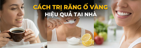 Cách trị răng ố vàng: Khi nụ cười cần được “giải cứu”