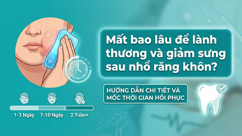 Nhổ răng khôn bao lâu thì lành và hết sưng?