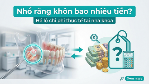 Nhổ răng khôn bao nhiêu tiền? Hé lộ chi phí thực tế tại phòng khám