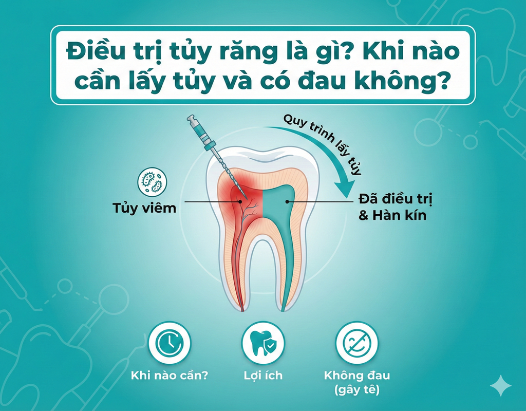 Điều trị tủy răng là gì? Khi nào cần lấy tủy và có đau không?