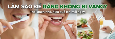 Làm sao để răng không bị vàng? Những thói quen nên duy trì mỗi ngày
