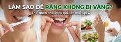 Làm sao để răng không bị vàng? Những thói quen nên duy trì mỗi ngày