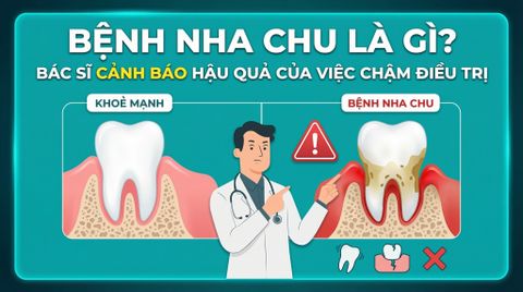 Bệnh nha chu là gì? Bác sĩ cảnh báo hậu quả nếu điều trị quá muộn