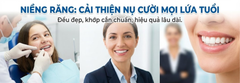 Niềng răng là gì và những điều cần biết để đạt hiệu quả cao