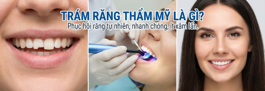 Trám răng thẩm mỹ là gì và khi nào nên thực hiện?