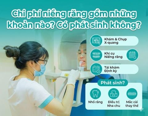Chi phí niềng răng gồm những khoản nào? Có phát sinh không?