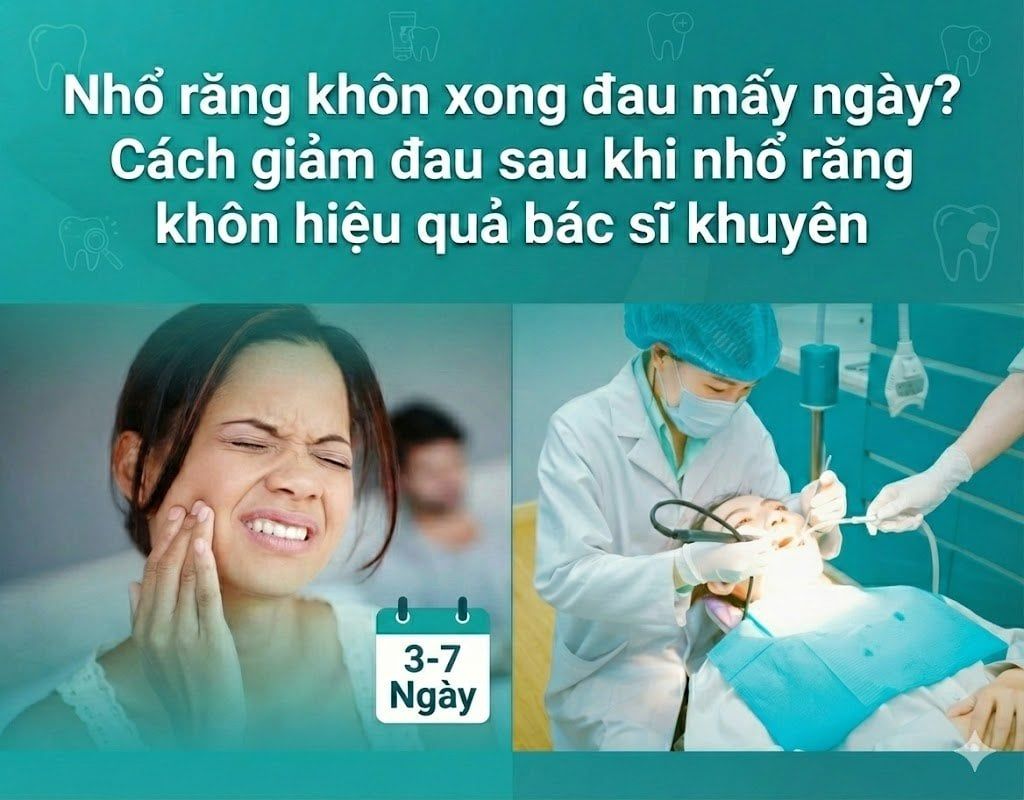 Nhổ răng khôn xong đau mấy ngày? Cách giảm đau sau khi nhổ răng khôn hiệu quả bác sĩ khuyên