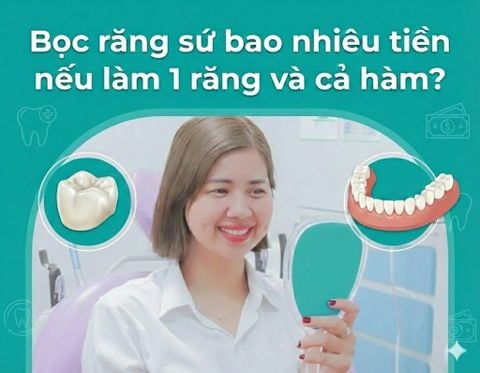 Bọc răng sứ bao nhiêu tiền nếu làm 1 răng và cả hàm?