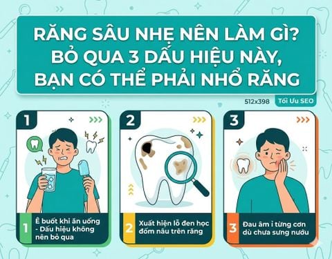 Răng sâu nhẹ nên làm gì? Bỏ qua 3 dấu hiệu này, bạn có thể phải nhổ răng