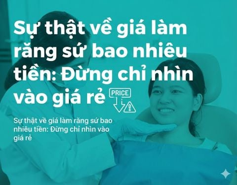 Sự thật về giá làm răng sứ bao nhiêu tiền: Đừng chỉ nhìn vào giá rẻ