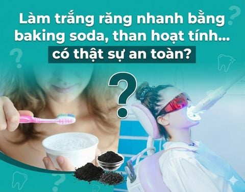 Làm trắng răng nhanh bằng baking soda, than hoạt tính… có thật sự an toàn?