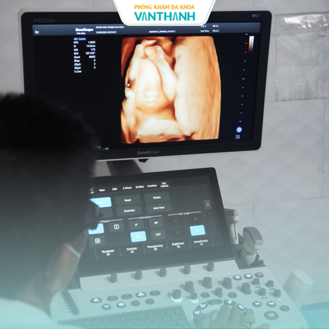 Trải nghiệm siêu âm 5D tại phòng khám đa khoa Vạn Thành