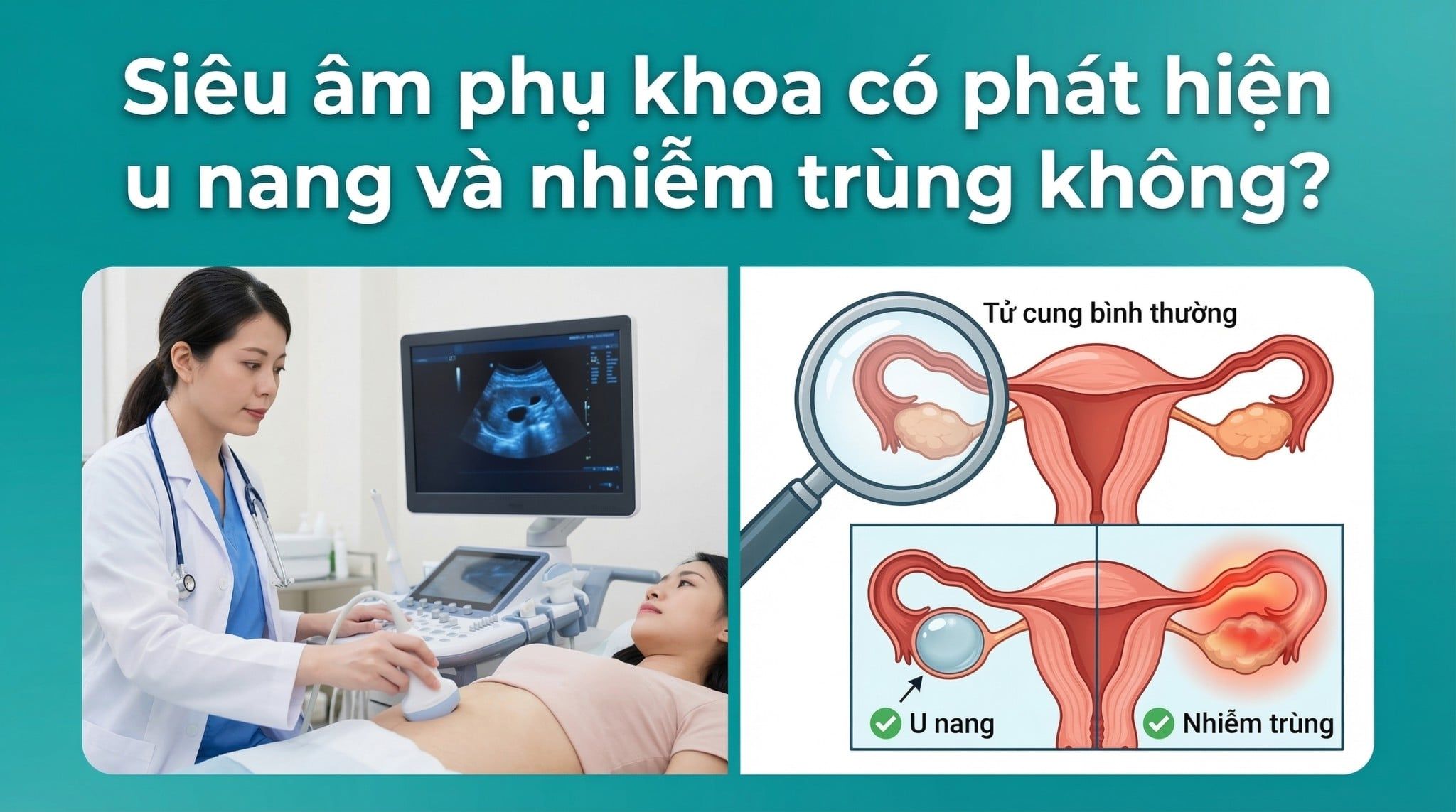 Siêu âm phụ khoa có phát hiện u nang, viêm nhiễm không?
