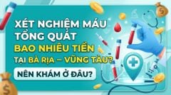 Chi phí xét nghiệm máu tổng quát tại Bà Rịa - Vũng Tàu bao nhiêu? Nên làm ở đâu?
