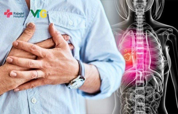 Điểm Danh Những Biểu Hiện Ung Thư Phổi Bạn Cần Biết