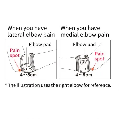 6601a2c0442e87fb60ec6ad0_elbow_band_05.webp