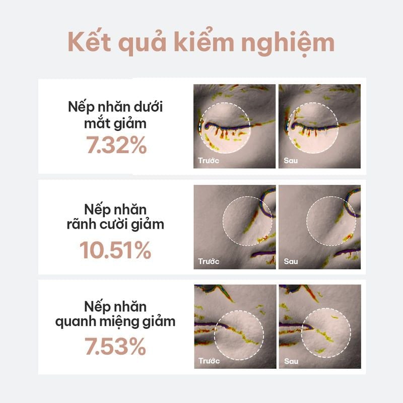 Serum B.O.M Hỗ Trợ Dưỡng Sáng, Mờ Nếp Nhăn Snail Mucin Power Ampoule 30ml