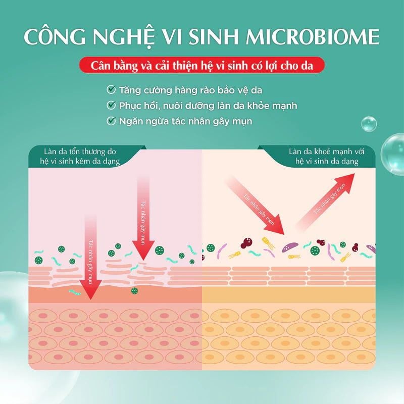 Gel Dưỡng Ẩm Hada Labo Cho Da Nhạy Cảm Acne Care Calming Gel Cream 50g