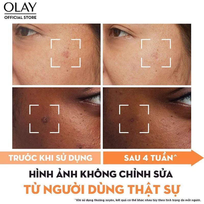 Kem Dưỡng Olay Hỗ Trợ Dưỡng Sáng Da, Làm Mờ Vết Thâm, Đốm Nâu Luminous Niacinamide + Vitamin C Moisturizer 50g