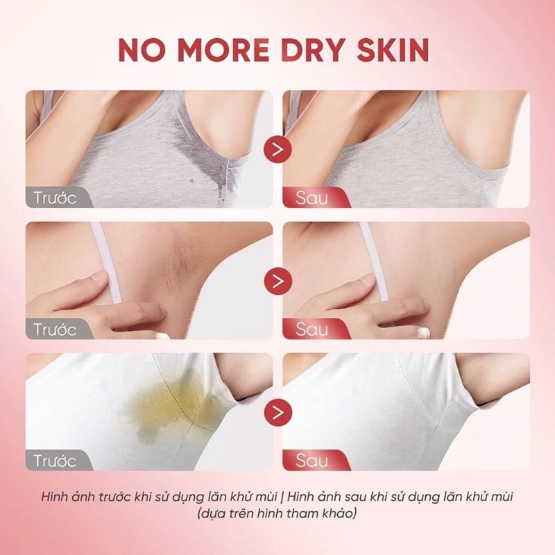 Lăn Khử Mùi Grace And Glow Dưỡng Sáng Da, Ngăn Ngừa Mồ Hôi Deodorant Serum 50ml