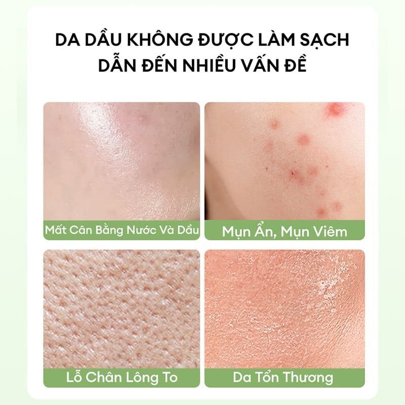 Gel Rửa Mặt Colorkey Trà Xanh Luminous Green Tea Purifying Gel Cleanser 100g