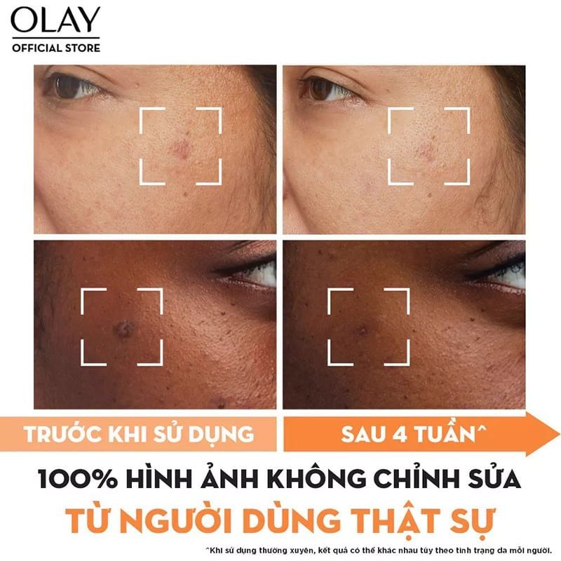Serum Olay Hỗ Trợ Dưỡng Sáng Da, Làm Mờ Vết Thâm, Đốm Nâu Luminous Niacinamide + Vitamin C Super Serum 30ml