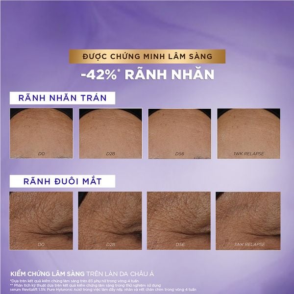  Kem Dưỡng Ban Đêm L'oreal Hỗ Trợ Ngăn Lão Hóa Da Paris Revitalift Hyaluronic Acid Line Plumping Dream Cream Night 50ml 