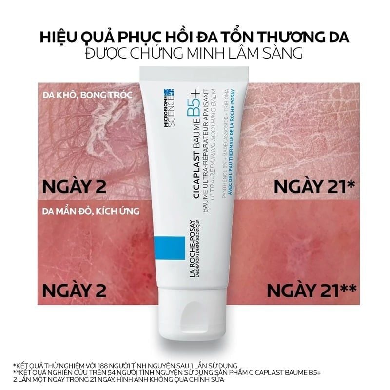 Kem Dưỡng La Roche-Posay Làm Dịu, Hỗ Trợ Phục Hồi Da, Đa Công Dụng Laboratoire Dermatologique Cicaplast Baume B5+