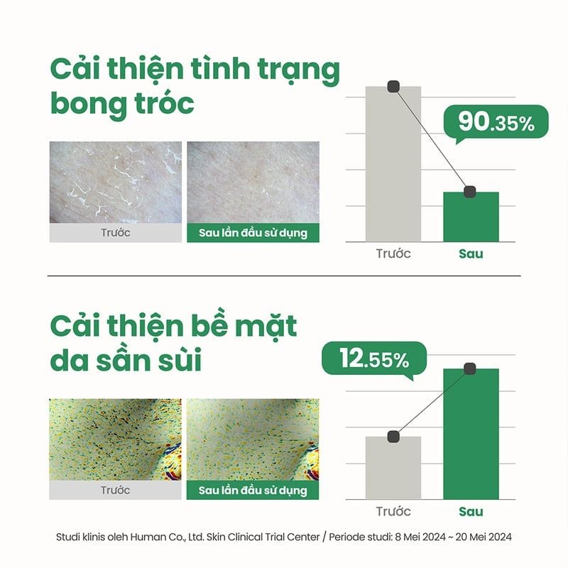 Gel Tẩy Tế Bào Chết Hóa Học Axis-Y Dịu Nhẹ Pha Resurfacing Glow Peel 50ml