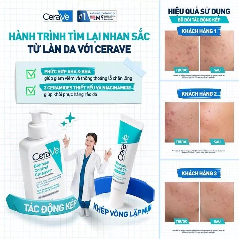 Gel Dưỡng Cerave Hỗ Trợ Giảm Mụn, Mờ Thâm Blemish Control Gel 40ml