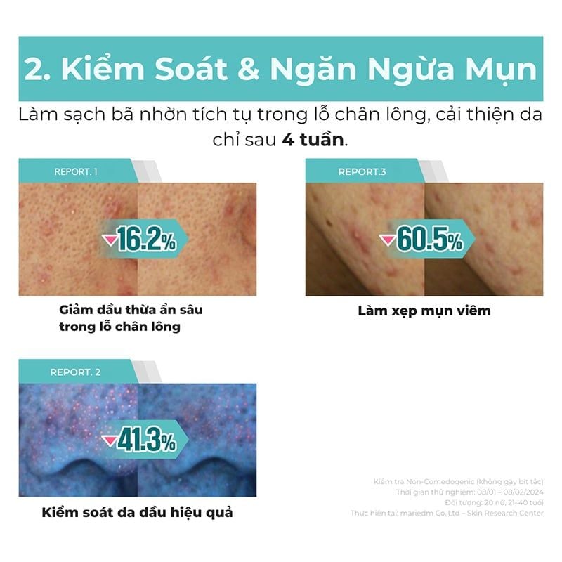 Kem Dưỡng numbuzin Làm Dịu Da, Hỗ Trợ Phục Hồi Da No.1 Pantothenic B5 Active Soothing Cream 80ml