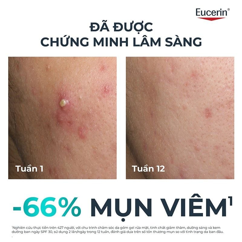 Tinh Chất Dưỡng Eucerin Hỗ Trợ Sáng Da, Giảm Thâm Mụn Dermopure Clinical Triple Action 40ml