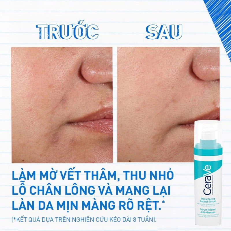 Serum Cerave Giúp Hỗ Trợ Mờ Thâm Mụn Resurfacing Retinol Serum 30ml