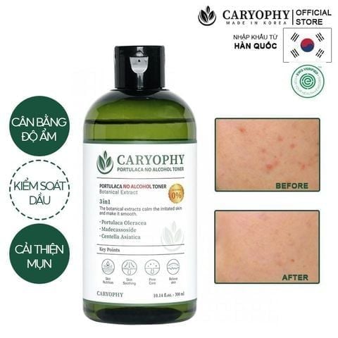 Nước Hoa Hồng Caryophy Chăm Sóc Da Dầu Mụn Portulaca Toner 300ml