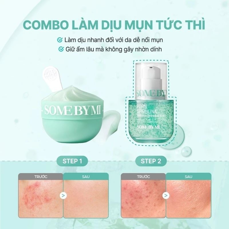 Serum Some By Mi Làm Dịu Da Mụn, Hỗ Trợ Phục Hồi PDRN Spirulina Soothing Repair Serum 50ml