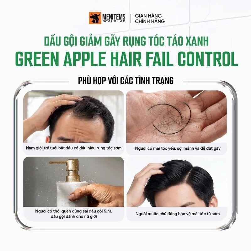 Dầu Gội Menitems Hỗ Trợ Giảm Rụng Tóc Táo Xanh Green Apple Hair Fall Control 300ml
