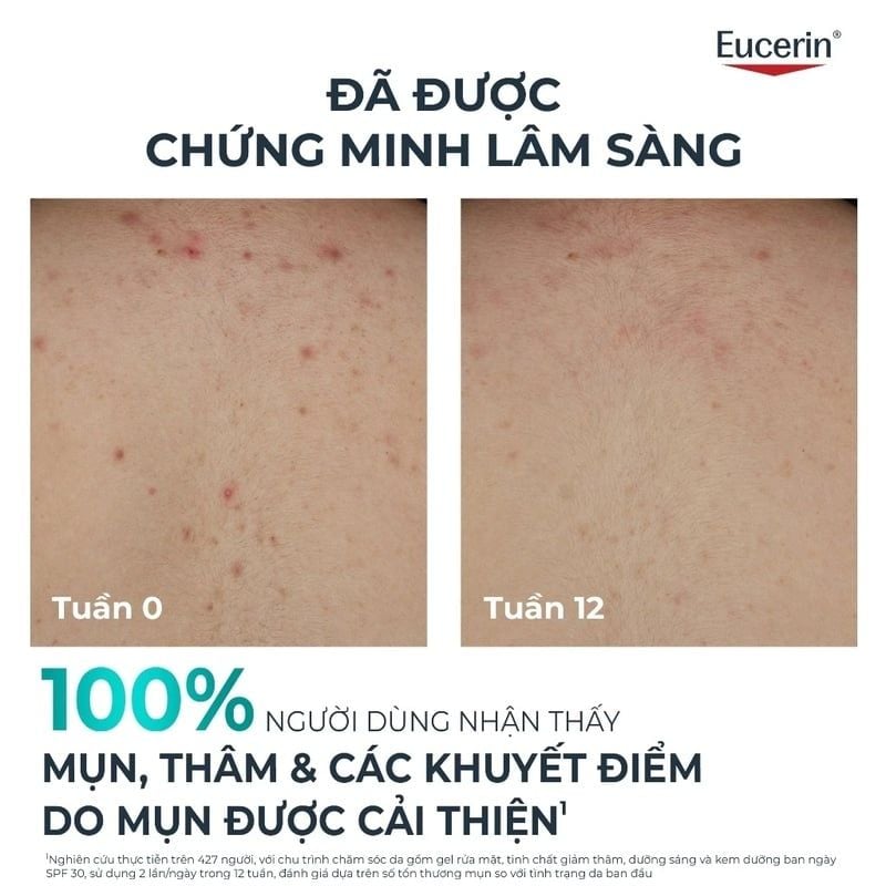Kem Dưỡng Thể Eucerin Cho Da Mụn Thâm, Hỗ Trợ Mờ Thâm Mụn, Dưỡng Ẩm Dermopure Clinical Correcting Body Care 200ml