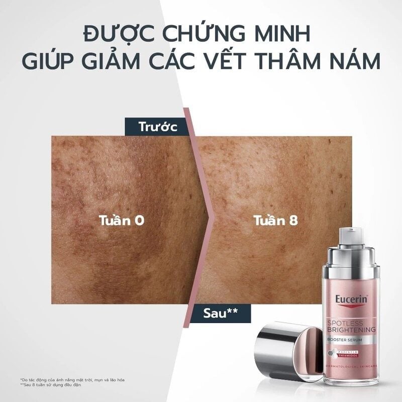 Serum Eucerin Hỗ Trợ Giảm Thâm Nám & Dưỡng Sáng Da Spotless Brightening Booster Serum 30ml