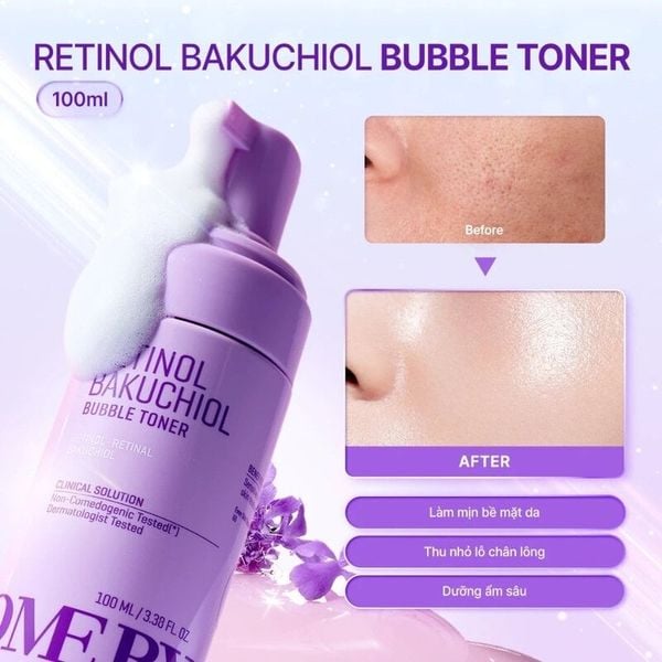  Nước Hoa Hồng Some By Mi Retinol Bakuchiol Bubble Toner 100ml 