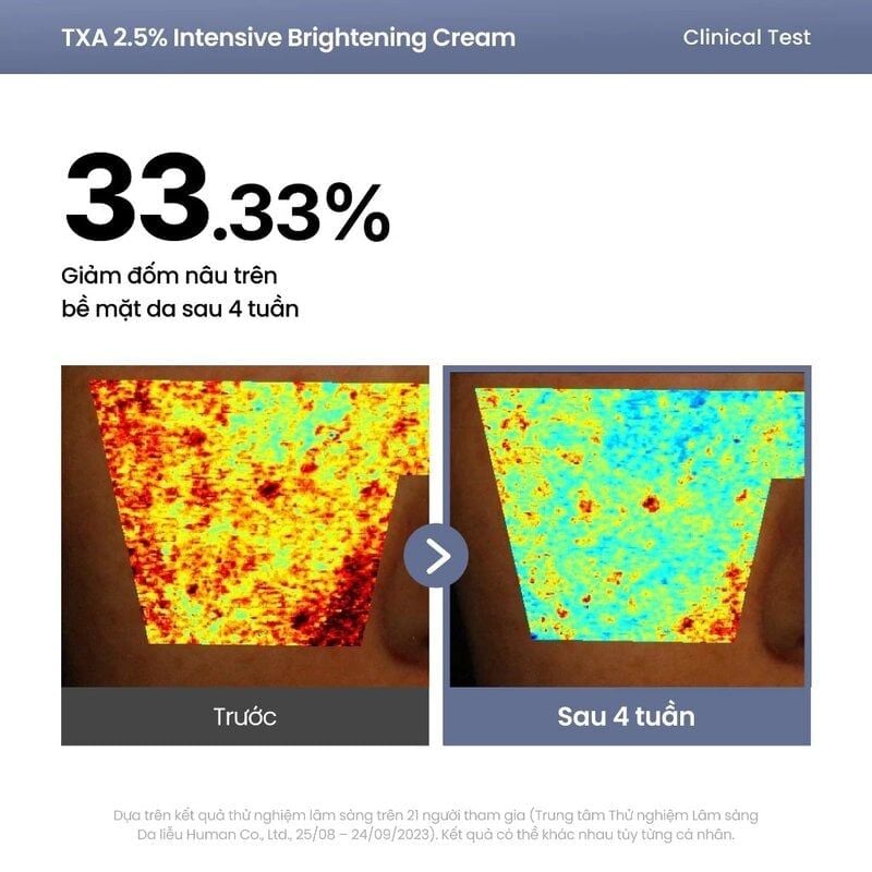 Kem Dưỡng Axis-Y Sáng Da Chuyên Sâu TXA 2.5% Intensive Brightening Cream 50ml