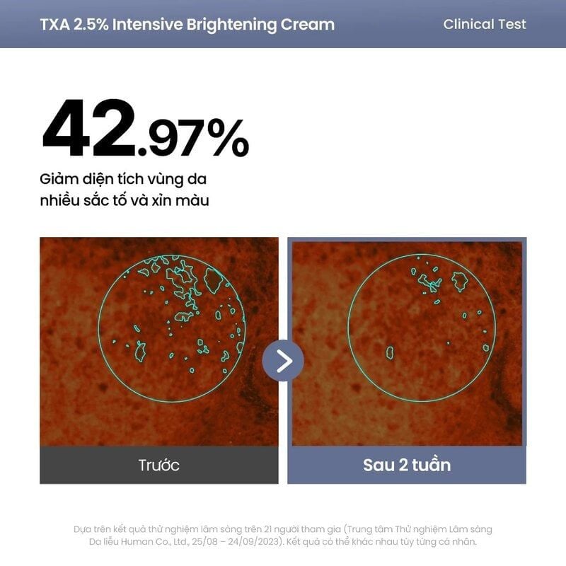 Kem Dưỡng Axis-Y Sáng Da Chuyên Sâu TXA 2.5% Intensive Brightening Cream 50ml