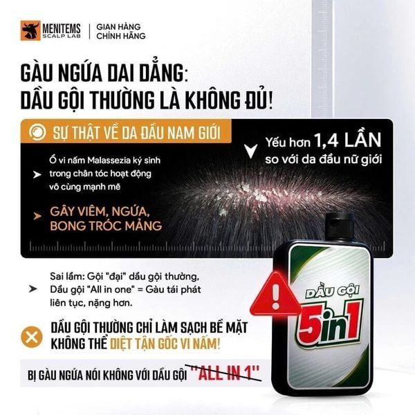  Dầu Gội Menitems Làm Sạch Gàu Chanh Dây Menitems Daklak Passion Seed 300ml 