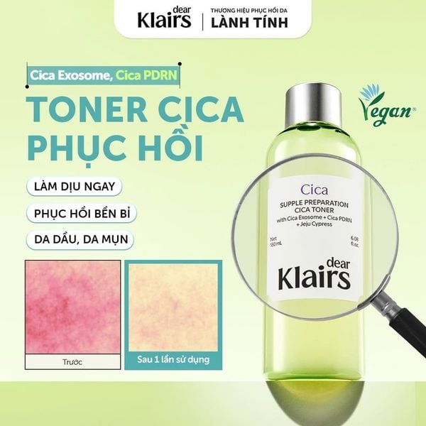  Nước Hoa Hồng Dear Klairs Làm Dịu, Hỗ Trợ Phục Hồi Da Supple Preparation Cica Toner 180ml 