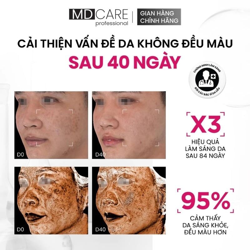 Serum Hỗ Trợ Dưỡng Sáng Da MD CARE Professional Brightenyl Serum Advanced Brightening Complex 30ml