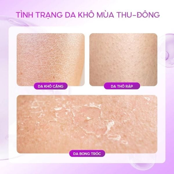  Sữa Dưỡng Thể Dạng Gel Grace And Glow Black Dưỡng Ẩm, Làm Sáng Da Opium White-B3 Bright Body Gel Serum 150ml 